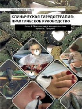 Книга “Клінічна гірудотерапія: практичне керівництво. Книга 2” – Сухов К.