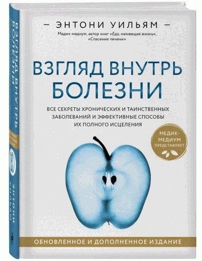 Книга “Погляд усередину хвороби” – Вільямс Е. (Тверда обкладинка)
